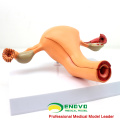 VENDER 12442 Estructura uterina Anatomical Model Anatomy Reproductive System